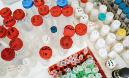 Günlük Kombinler: Her Mevsime Uygun Öneriler