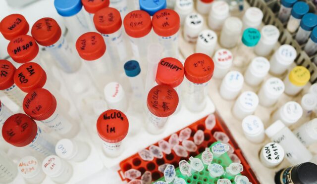 Günlük Kombinler: Her Mevsime Uygun Öneriler